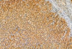 Invitrogen MCD Polyclonal Antibody 100 &mu;L; Unconjugated:Antibodies,