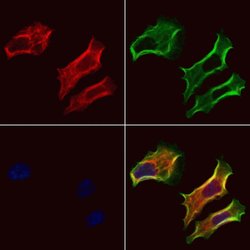 Invitrogen PIEZO1 Polyclonal Antibody 100 μL; Unconjugated:Antibodies,