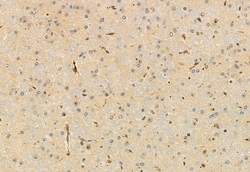 Invitrogen PIEZO1 Polyclonal Antibody 100 μL; Unconjugated:Antibodies,