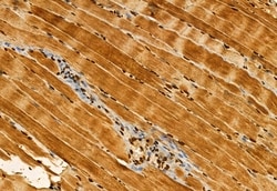 Invitrogen AP3B1 Polyclonal Antibody 100 &mu;L; Unconjugated:Antibodies,