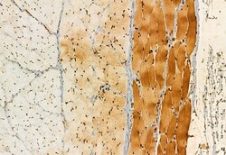 Invitrogen AP3B1 Polyclonal Antibody 100 &mu;L; Unconjugated:Antibodies,