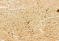 Invitrogen AP3B1 Polyclonal Antibody 100 &mu;L; Unconjugated:Antibodies,