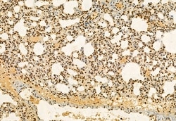 Invitrogen AP3B1 Polyclonal Antibody 100 &mu;L; Unconjugated:Antibodies,