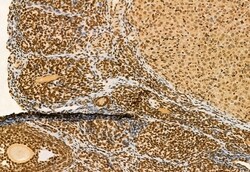 Invitrogen AP3B1 Polyclonal Antibody 100 &mu;L; Unconjugated:Antibodies,