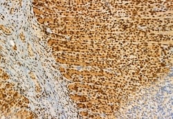 Invitrogen AP3B1 Polyclonal Antibody 100 &mu;L; Unconjugated:Antibodies,