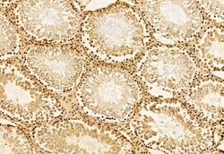 Invitrogen AP3B1 Polyclonal Antibody 100 &mu;L; Unconjugated:Antibodies,