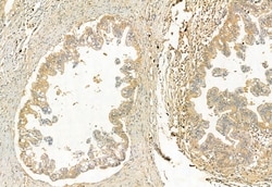 Invitrogen CISD2 Polyclonal Antibody 100 μL; Unconjugated:Antibodies,