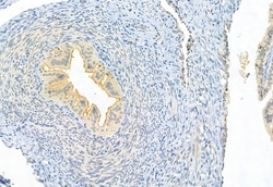 Invitrogen CISD2 Polyclonal Antibody 100 μL; Unconjugated:Antibodies,