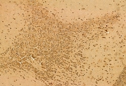 Invitrogen QSOX1 Polyclonal Antibody 100 &mu;L; Unconjugated:Antibodies,