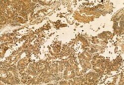 Invitrogen QSOX1 Polyclonal Antibody 100 &mu;L; Unconjugated:Antibodies,