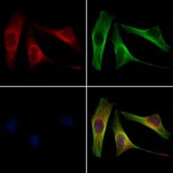 Invitrogen RDH10 Polyclonal Antibody 100 &mu;L; Unconjugated:Antibodies,