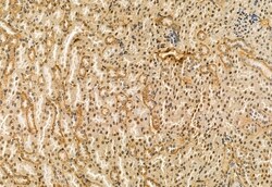 Invitrogen RDH10 Polyclonal Antibody 100 &mu;L; Unconjugated:Antibodies,