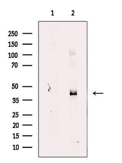 Invitrogen RDH10 Polyclonal Antibody 100 &mu;L; Unconjugated:Antibodies,