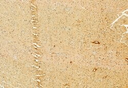 Invitrogen C9orf72 Polyclonal Antibody 100 &mu;L; Unconjugated:Antibodies,