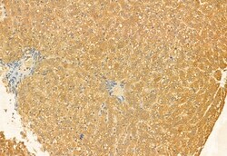 Invitrogen C9orf72 Polyclonal Antibody 100 &mu;L; Unconjugated:Antibodies,