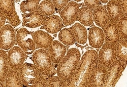Invitrogen C9orf72 Polyclonal Antibody 100 &mu;L; Unconjugated:Antibodies,