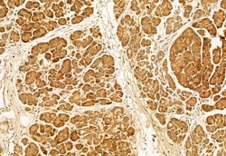 Invitrogen C9orf72 Polyclonal Antibody 100 &mu;L; Unconjugated:Antibodies,