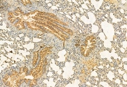 Invitrogen C9orf72 Polyclonal Antibody 100 &mu;L; Unconjugated:Antibodies,