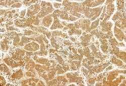 Invitrogen C9orf72 Polyclonal Antibody 100 &mu;L; Unconjugated:Antibodies,