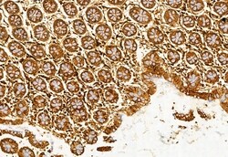 Invitrogen TCP-1 gamma Polyclonal Antibody 100 &mu;L; Unconjugated:Antibodies,