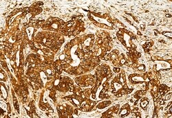 Invitrogen TCP-1 gamma Polyclonal Antibody 100 &mu;L; Unconjugated:Antibodies,