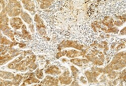 Invitrogen TCP-1 gamma Polyclonal Antibody 100 &mu;L; Unconjugated:Antibodies,