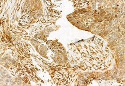 Invitrogen TCP-1 gamma Polyclonal Antibody 100 &mu;L; Unconjugated:Antibodies,