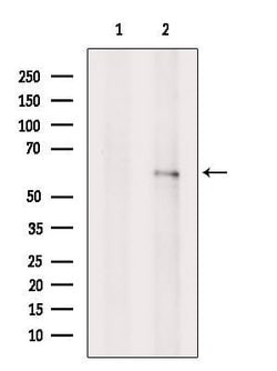 Invitrogen TCP-1 gamma Polyclonal Antibody 100 &mu;L; Unconjugated:Antibodies,