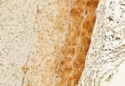 Invitrogen GluD1 Polyclonal Antibody 100 &mu;L | Buy Online | Invitrogen&trade; | Fisher Scientific