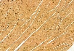 Invitrogen GluD1 Polyclonal Antibody 100 &mu;L | Buy Online | Invitrogen&trade; | Fisher Scientific