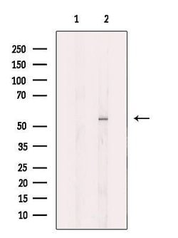 Invitrogen GluD1 Polyclonal Antibody 100 &mu;L | Buy Online | Invitrogen&trade; | Fisher Scientific