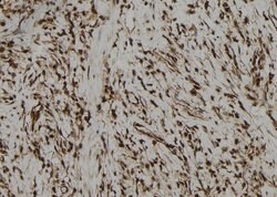 Invitrogen PBXIP1 Polyclonal Antibody 100 &mu;L; Unconjugated:Antibodies,