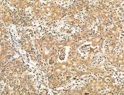 Invitrogen PBXIP1 Polyclonal Antibody 100 &mu;L; Unconjugated:Antibodies,