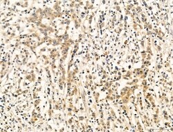 Invitrogen PBXIP1 Polyclonal Antibody 100 &mu;L; Unconjugated:Antibodies,