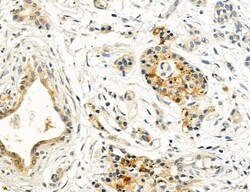 Invitrogen PBXIP1 Polyclonal Antibody 100 &mu;L; Unconjugated:Antibodies,