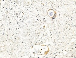 Invitrogen PBXIP1 Polyclonal Antibody 100 &mu;L; Unconjugated:Antibodies,
