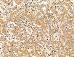 Invitrogen PBXIP1 Polyclonal Antibody 100 &mu;L; Unconjugated:Antibodies,
