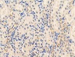 Invitrogen PBXIP1 Polyclonal Antibody 100 &mu;L; Unconjugated:Antibodies,