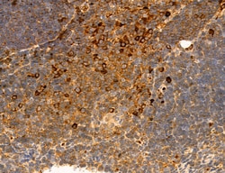 Invitrogen PPAT Polyclonal Antibody 100 μL; Unconjugated:Antibodies,