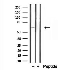 Invitrogen PPAT Polyclonal Antibody 100 μL; Unconjugated:Antibodies,
