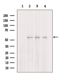 Invitrogen PPAT Polyclonal Antibody 100 μL; Unconjugated:Antibodies,