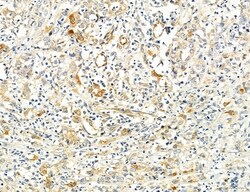 Invitrogen SEC61G Polyclonal Antibody 100 μL; Unconjugated:Antibodies,