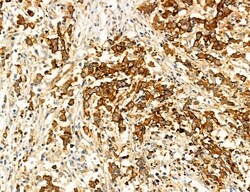 Invitrogen SEC61G Polyclonal Antibody 100 μL; Unconjugated:Antibodies,