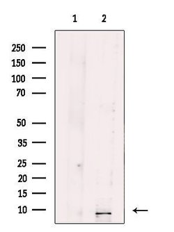 Invitrogen SEC61G Polyclonal Antibody 100 μL; Unconjugated:Antibodies,