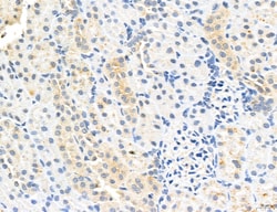 Invitrogen CHMP2A Polyclonal Antibody 100 μL; Unconjugated:Antibodies,