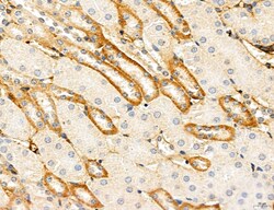Invitrogen CHMP2A Polyclonal Antibody 100 μL; Unconjugated:Antibodies,