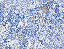 Invitrogen CHMP2A Polyclonal Antibody 100 μL; Unconjugated:Antibodies,
