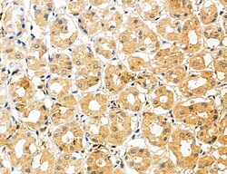 Invitrogen CHMP2A Polyclonal Antibody 100 μL; Unconjugated:Antibodies,