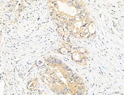 Invitrogen CHMP2A Polyclonal Antibody 100 μL; Unconjugated:Antibodies,