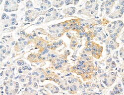 Invitrogen CHMP2A Polyclonal Antibody 100 μL; Unconjugated:Antibodies,